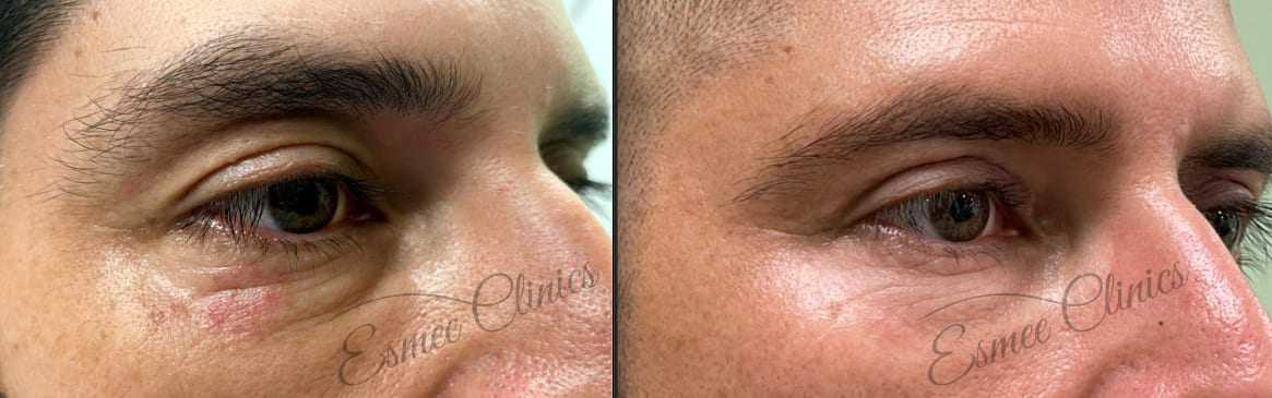 Before and After img